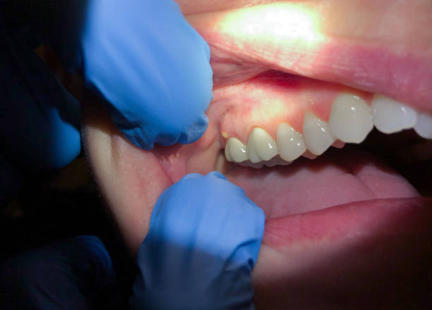Best Pediatric Emergency Dentist in Mesa Del Caballo, AZ